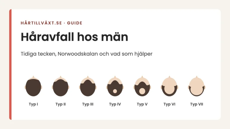 Håravfall hos män: Norwoodskalan typ I–VII, från oförändrat hårfäste till en krans av hår runt sidorna